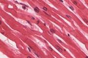 نقش C/EBPβ در پیشبرد خفتگی سلول های بنیادی عضلانی