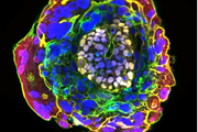 تولید اولین مدل جنین انسان از سلول‌های بنیادی جنینی