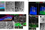 ارگانوئید/سلول‌های شبکیه مشتق از سلول‌های بنیادی پرتوان برای درمان‌های بازسازی شبکیه 