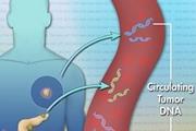 تشخیص DNA تومور در نمونه خون
