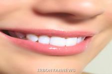 دندان های بیولوژیکی جایگزینی برای ایمپلنت های دندانی