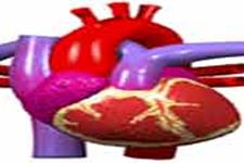 بهبود عملکرد قلب به کمک سلول های بنیادی بیمار