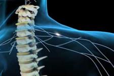 گامی جدید در درمان آسیب‌های نخاعی با تحریک الکتریکی