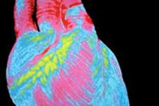محققین پروتئینی را کشف کرده اند که به عنوان یک سوئیچ مرکزی برای تقسیم سلولی قلب عمل می کند