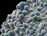 جایگزینی سلول های بنیادی در بافت های سرطانی