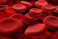 استفاده از خون برای بیماران باید منطقی و مسوولانه باشد