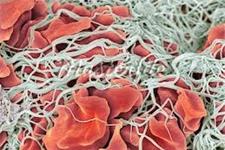 جدیدترین یافته دانشمندان در مورد انعقاد خون