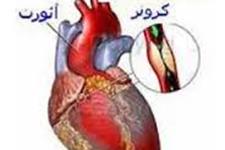 بیماری عروق کرونری غیر انسدادی بین 28 الی 44 درصد با افزایش خطر حمله قلبی همراه است