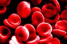 داروی جدید برای سرطان های خونی در فاز دو مطالعات بالینی