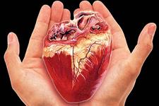 حدود یک چهارم عمل های پیوند قلب جهان در ایران اجرا شده اند