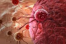 بیومارکرهای جدید سرطان کولون