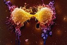 پروتئین ZEB1 مقاومت تومور سرطانی به پرتودرمانی را افزایش می دهد
