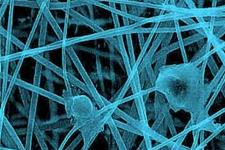 ایجاد بافت عصبی سه بعدی با استفاده از داربست های نانوفیبری و هیدروژل های زیست سازگار 