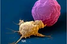 شناسایی سلول هایی که رشد تومور را تقویت و حملات ایمنی ضد سرطانی را سرکوب می کنند