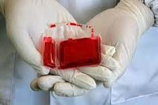 اثر ذخیره سازی واحدهای خون بند ناف با دوز سلولی بالا روی بیماران با قومیت های مختلف