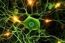 افزایش ده برابر سرعت بازسازی شبکه های عصبی