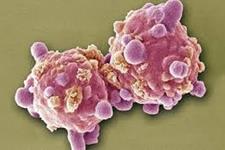 شناسایی دقیق تر سلول هایی که منجر به عود مجدد سرطان در کودکان مبتلا به لوکمیا می شوند