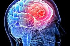 یک رویکرد جدید احتمالی برای متوقف کردن سرطان های مغزی لاعلاج