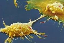 مولکول فلورسنتی که نشان می دهد سلول های بنیادی سرطانی چگونه به طور انتخابی مهار می شوند