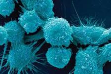 مهار کننده های HDAC امیدوار کننده در مبارزه با سلول های بنیادی سرطانی