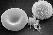 تحقیقاتی در زمینه سلول های بنیادی سرطانی و  اطلاعاتی در مورد متاستاز