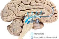 رشد مجدد نورون های دوپامینرژیک، درمانی جدید برای بیماری پارکینسون