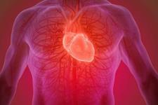 سه بیمار قلبی بعد از درمان با سلول های بنیادی شرایط بهتری را تجربه کرده اند