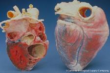 مدلی جدید برای کشف دارو برای بیماری دریچه های قلبی