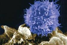 استفاده موفقیت آمیز از سلول های T مدیفه شده برای هدف قرار دادن عفونت های ویروسی بعد از پیوند سلول های بنیادی خون ساز