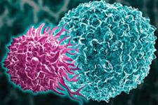 ایمنی درمانی CAR-T Cell، موثر برای درمان لنفوما