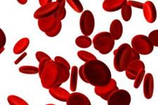 درمان نقص ژنتیکی با سلول‌های خون بند ناف برای نخستین بار