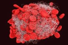 شناسایی جهش هایی بر سر راه بلوغ سلول های خونی سالم
