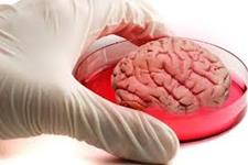 مینی مغزها ممکن است شبیه مغز طبیعی چین خوردگی پیدا کنند