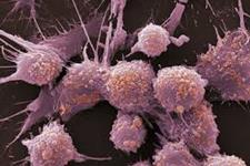 استراتژی های درمانی برای هدف قرار دادن سلول های بنیادی سرطانی