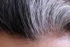 ارتباط موی خاکستری برای فعالیت سیستم ایمنی و عفونت ویروسی
