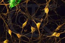 نقش گیرنده دیستروگلیکان در ایجاد نیچ سلول های بنیادی عصبی