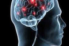 احیای عملکرد نورون ها در رت های پارکینسونی با ژن درمانی مبتنی بر اولتراسوند