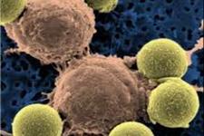 چرا سلول های بنیادی سرطانی نامیرا هستند