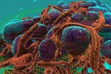 پروتئین های مسیر پیام رسانی هج هاگ سلول های بنیادی سرطانی را زنده نگه می دارند