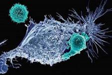 کشف مسیر رشد سلولهای سرطان سینه در سلول های جنینی  