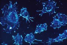 ایمنی درمانی سرطان ممکن است به روشی غیر قابل انتظار عمل کند