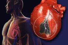 پروتئینی که رشد شریان کوچک به درون بافت قلبی آسیب دیده موش را افزایش می دهد