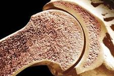 شناسایی پیش سازهای استخوانی برای تشکیل استخوان و ترمیم شکستگی با استفاده از Gli1