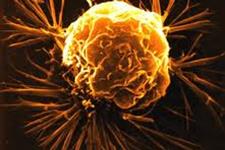 ملاتونین رشد سلول های بنیادی سرطان سینه را سرکوب می کند