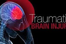 شبیه سازی اثرات آسیب ترومایی مغز در ظروف آزمایشگاهی