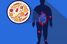 پاسخ های ایمنی ذاتی به رژیم غذایی پر چربی منجر به چاقی می شود