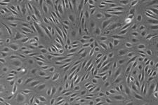 تولید سلول  های اندوتلیالی از سلول های بنیادی می تواند اطلاعاتی را در مورد بیماری های عروقی ارائه دهد
