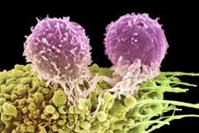 جداسازی سلول های بنیادی سرطانی به تحقیقات سرطان سرعت می بخشند