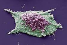 بین سلول های سرطانی و محیط شان یک دیالوگ دو طرفه وجود دارد