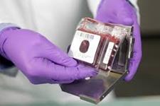 محققین خواهان آگاهی رسانی در مورد اهدای خون بند ناف 
